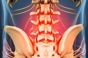 причины возникновения и симптомы остеохондроза